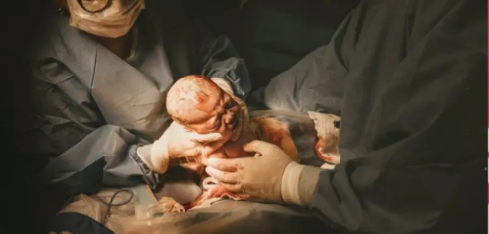 GERAL  Pesquisa investiga a dor em bebês nascidos por cesárea e parto  normal - Região em Destake